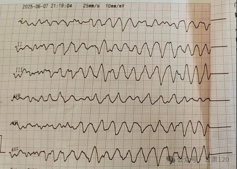 生死時速——省緊急醫療救援中心成功搶救一例心臟驟停患者 生死時速——省緊急醫療救援中心成功搶救一例心臟驟?;颊? width=